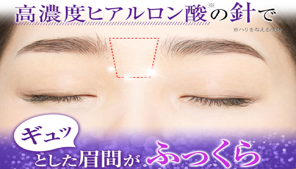 �u���ԃf�B�[�v�p�b�`�v�ň��l�̌����T�C�g�����ē�